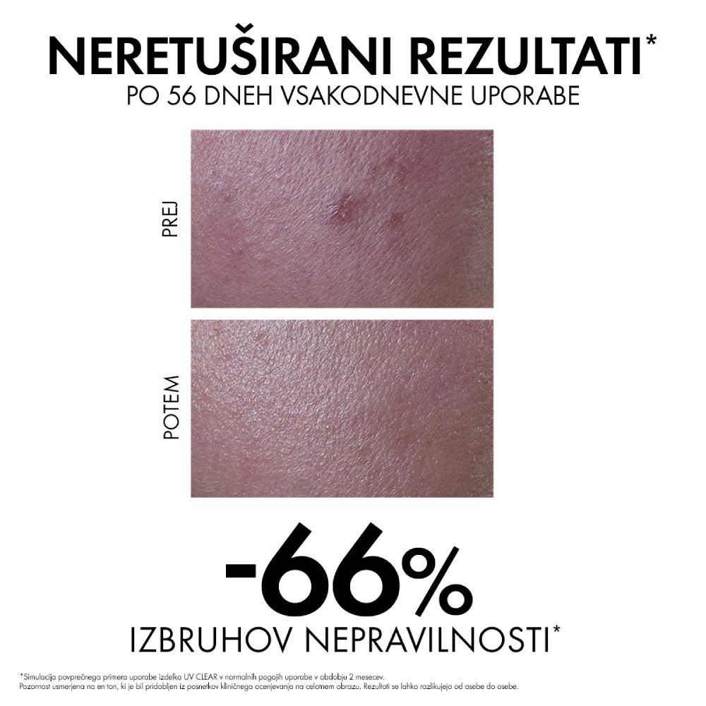 Vichy Capital Soleil UV-Clear, fluid za zaščito pred soncem proti nepravilnostim - ZF50+ (40 ml)