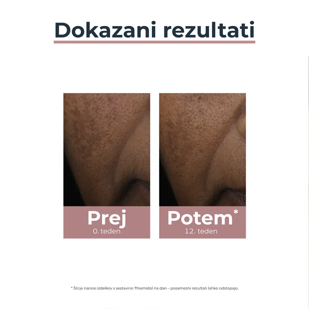 Eucerin Anti-Pigment, korektor proti pigmentnim madežem (5 ml)