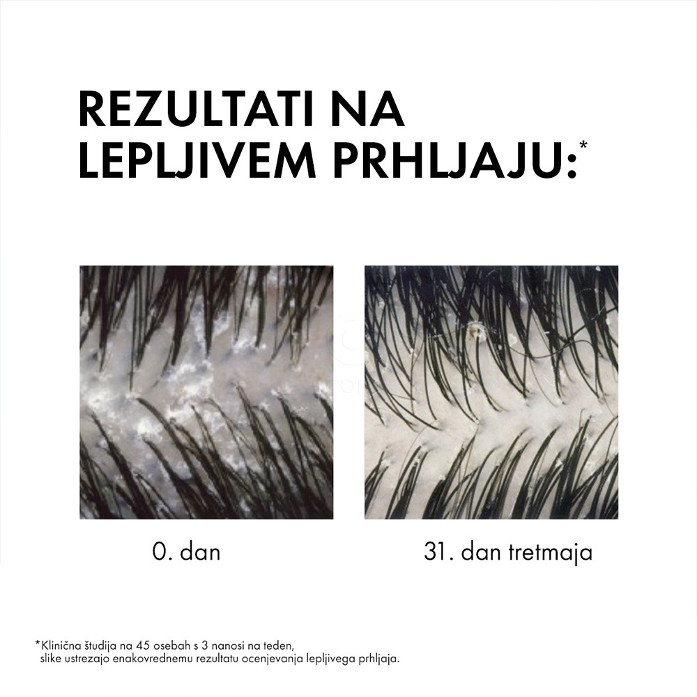 Vichy Dercos, šampon proti prhljaju za suhe lase - eko refill (390 ml)