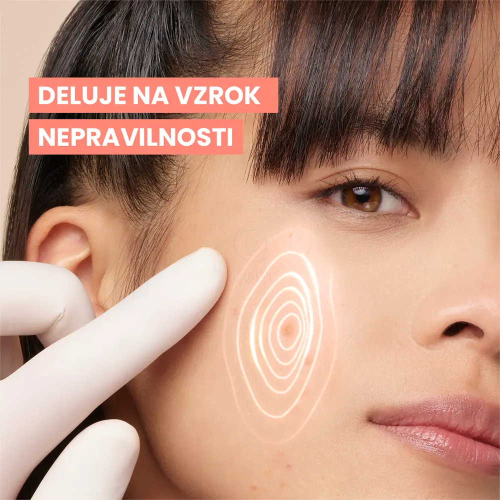 Avene Cleanance Comedomed+, intenzivna nega proti nepravilnostim (30 ml)