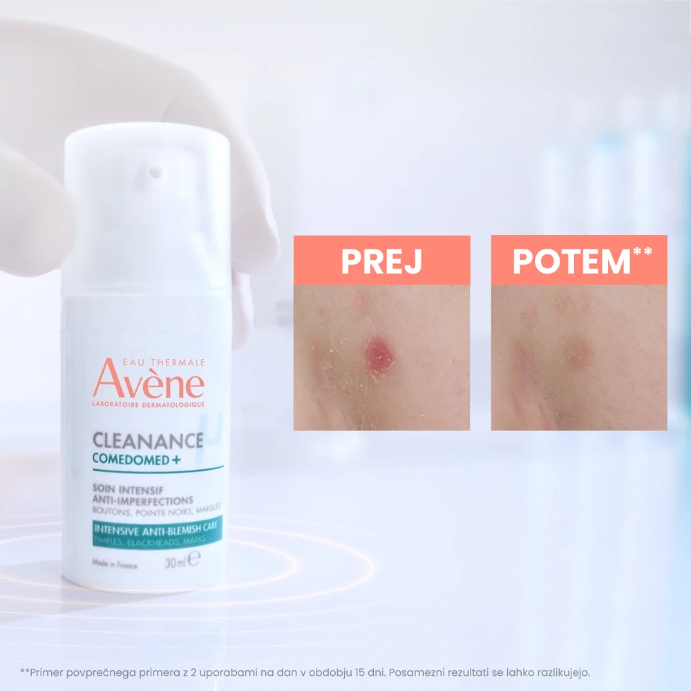 Avene Cleanance Comedomed+, intenzivna nega proti nepravilnostim (30 ml)