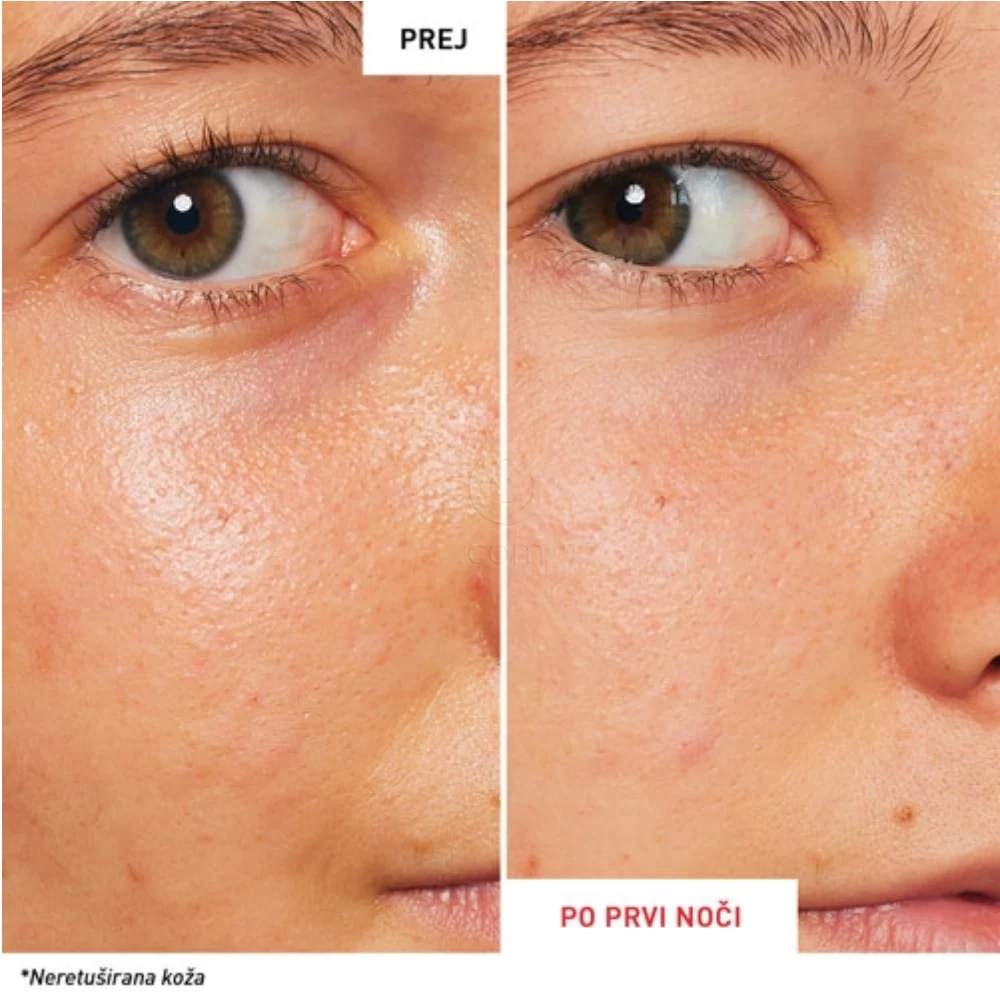 Erborian Skin Therapy, nočni serum (10 ml)