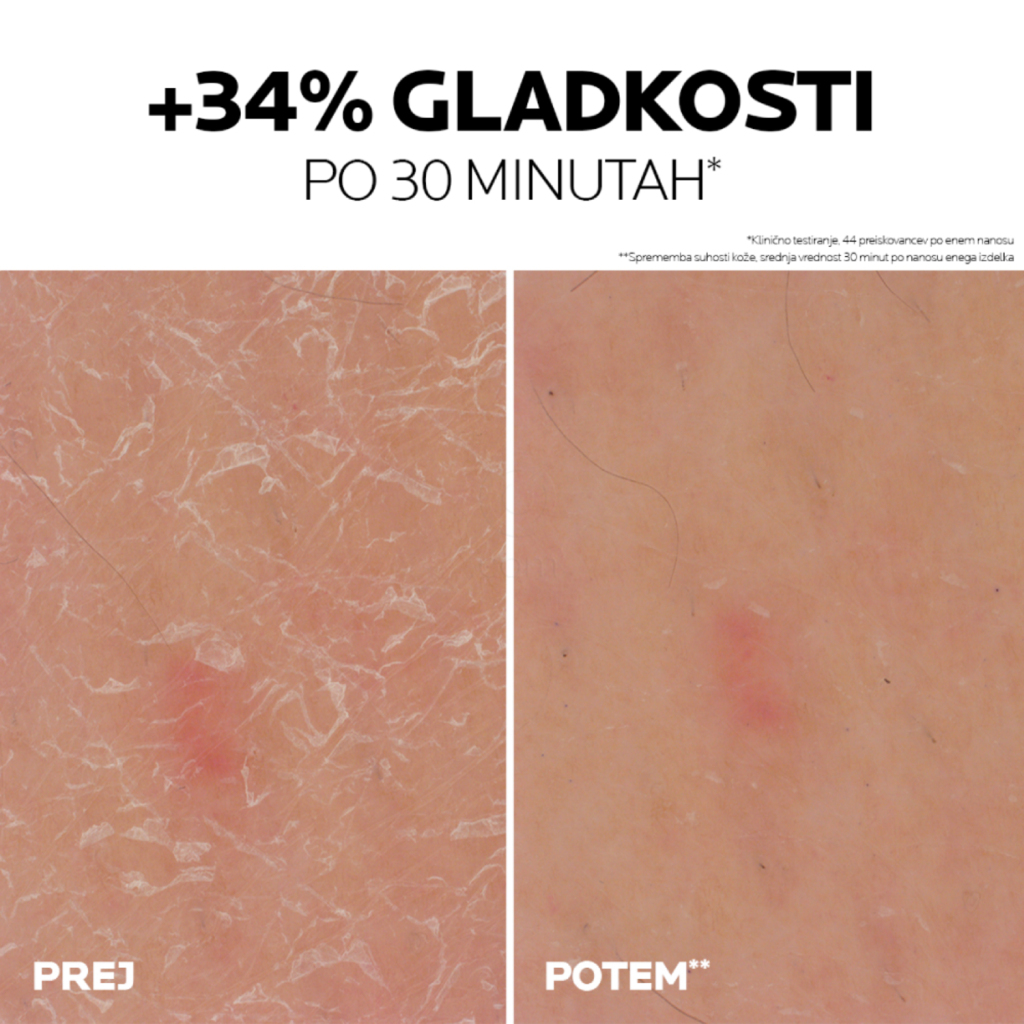 LRP Lipikar 30% Urea, gel za ciljano uporabo na suhih in grobih predelih kože (50 ml)