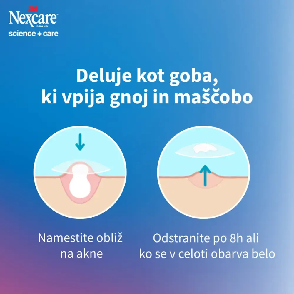 Nexcare Acne Patch, obliži za akne (15 obližev)