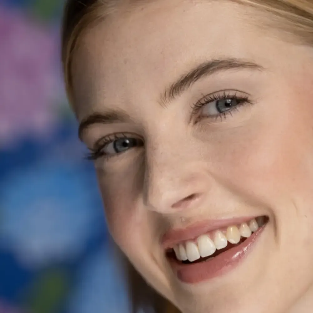 Nexcare Acne Patch, obliži za akne (15 obližev)