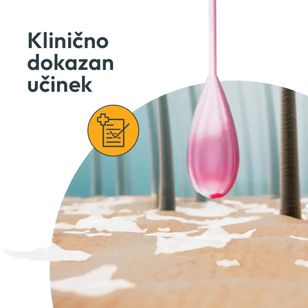 Oronazol 20 mg/g, zdravilni šampon (100 ml)