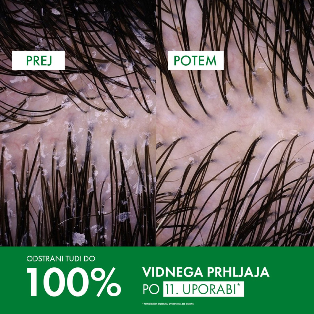 Vichy Dercos, šampon proti prhljaju za normalne in mastne lase (390 ml)