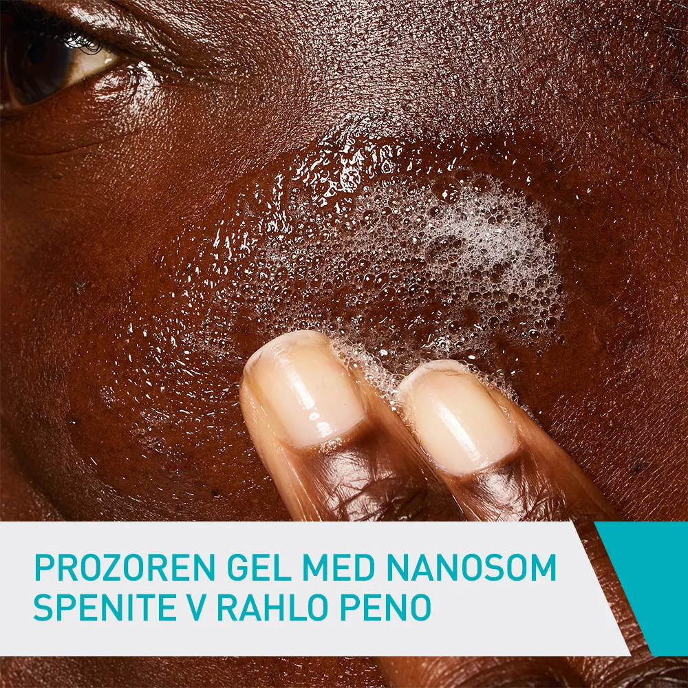 CeraVe, čistilni gel za kožo nagnjeno k nepravilnostim (236 ml)