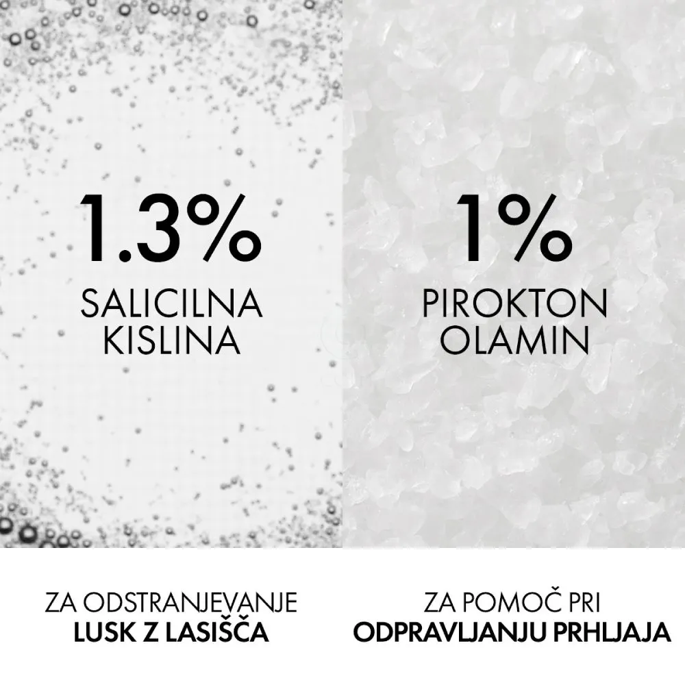 Vichy Dercos Anti dandruff K, šampon proti lepljivemu prhljaju in sebumu (250 ml)