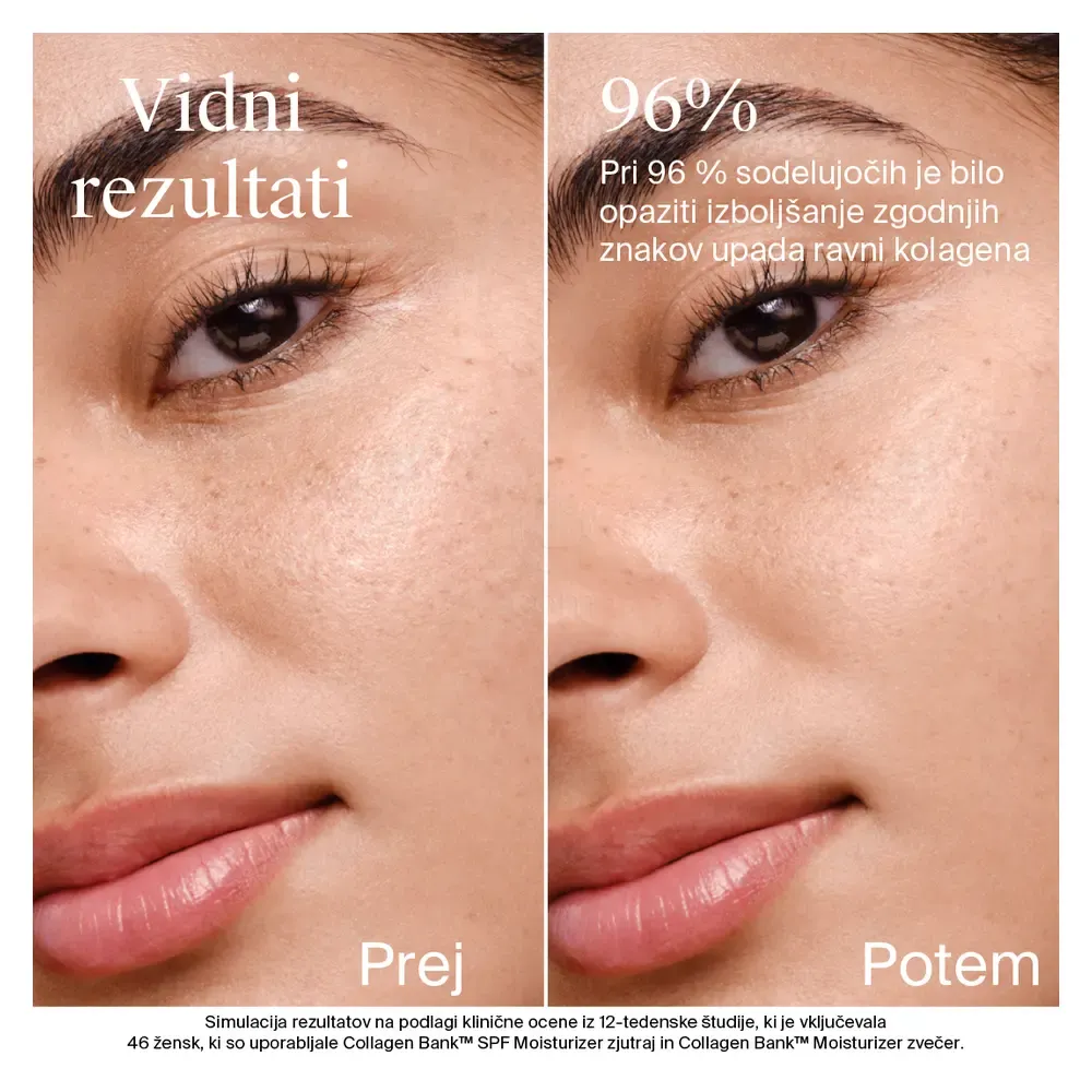 Neutrogena Collagen Bank Moisturizer, vlažilna krema - ZF30 (50 ml)