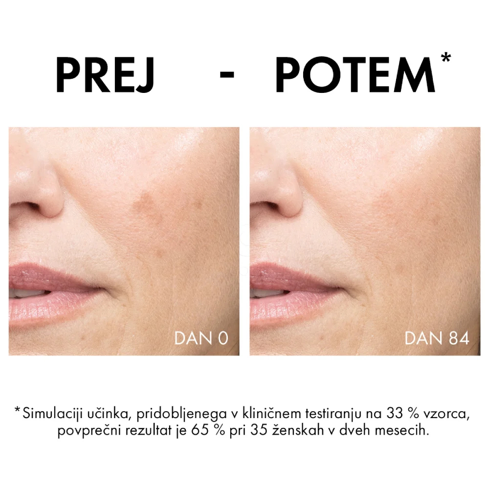 Vichy Liftactiv B3 Anti-Dark Spots, krema proti hiperpigmentacijskim madežem in gubam - ZF50 (50 ml)