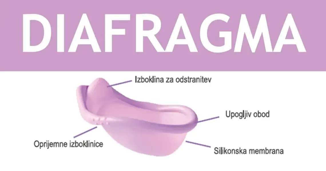 Nehormonska kontracepcija: Kako deluje diafragma?