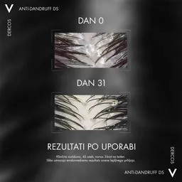 Vichy Dercos PSOlution, šampon za lasišče nagnjeno k luskavici (200 ml)