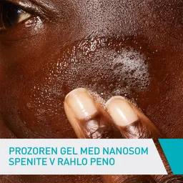 CeraVe, čistilni gel za kožo nagnjeno k nepravilnostim (236 ml)