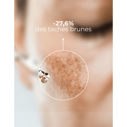 DermEden, koncentrat proti hiperpigmentacijam (3×10 ml)