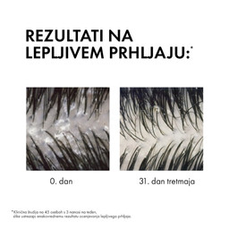 Vichy Dercos, šampon proti prhljaju za suhe lase (390 ml)