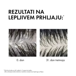 Vichy Dercos, šampon proti prhljaju za normalne in mastne lase (390 ml)