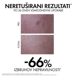 Vichy Capital Soleil UV-Clear, fluid za zaščito pred soncem proti nepravilnostim - ZF50+ (40 ml) 