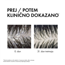 Vichy Dercos DS 2v1, dermokozmetični šampon in balzam proti prhljaju (200 ml)