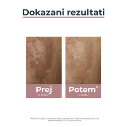 Eucerin Anti-Pigment Dual, serum proti hiperpigmentaciji (30 ml)