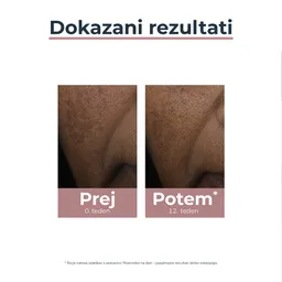 Eucerin Anti-Pigment, korektor proti pigmentnim madežem (5 ml)