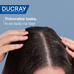 Ducray Kelual Squanorm, regulirajoči tretma šampon proti mastnemu prhljaju (200 ml)