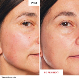 Erborian Skin Therapy, nočni serum (30 ml)