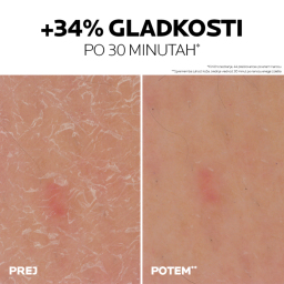 LRP Lipikar 30% Urea, gel za ciljano uporabo na suhih in grobih predelih kože (50 ml)