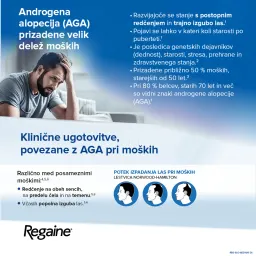 Regaine 50 mg/g, dermalna pena (60 g)