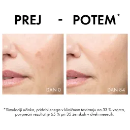 Vichy Liftactiv B3 Anti-Dark Spots, krema proti hiperpigmentacijskim madežem in gubam - ZF50 (50 ml)