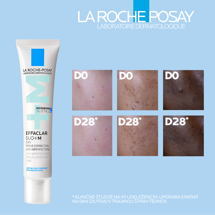 La Roche-Posay Effaclar Duo+M, 40 ml — koža pred uporabo in po 28 dneh uporabe